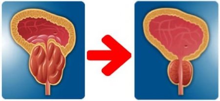 принцип действия